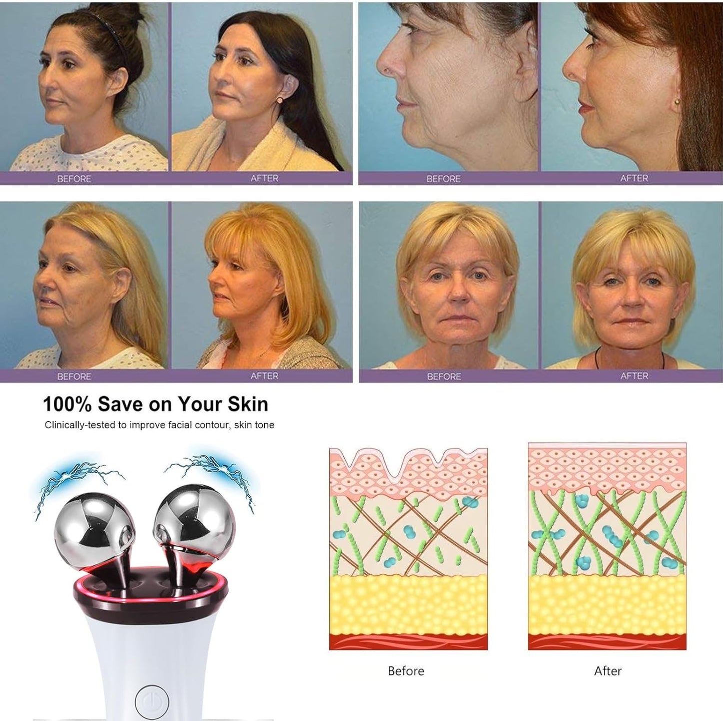 Glownova - Dispositivo De Microcorriente Facial